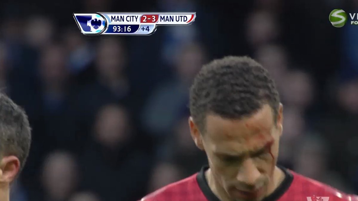 Fans kastade mynt mot United-spelarna. Rio Ferdinand började blöda från ögonbrynet.